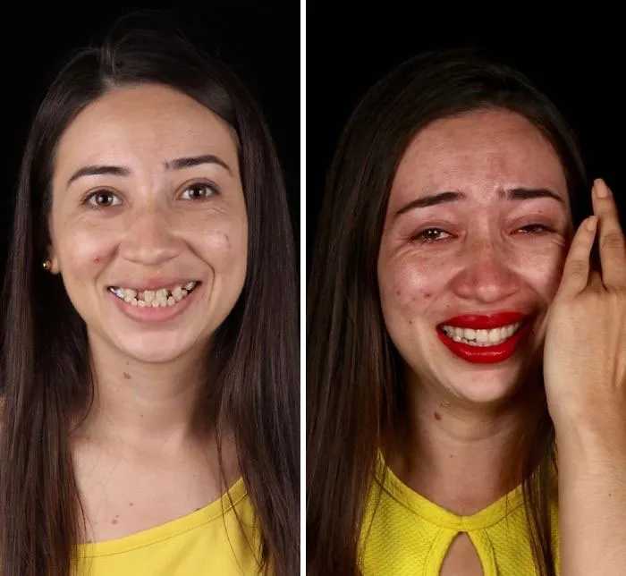 Un Dentista De Brasil Viaja Para Arreglar Gratis La Dentadura De Los Pobres