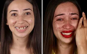 Brazilian Dentist Travels To Treat The Teeth Of Poor People For Free And Here Are 30 Transformations