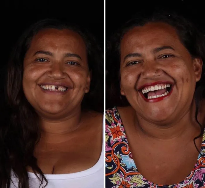 Un Dentista De Brasil Viaja Para Arreglar Gratis La Dentadura De Los Pobres