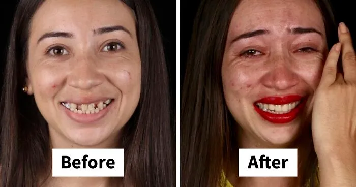 Brazilian Dentist Travels To Treat The Teeth Of Poor People For Free And Here Are 30 Transformations