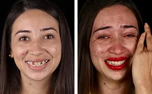 Brazilian Dentist Travels To Treat The Teeth Of Poor People For Free And Here Are 30 Transformations