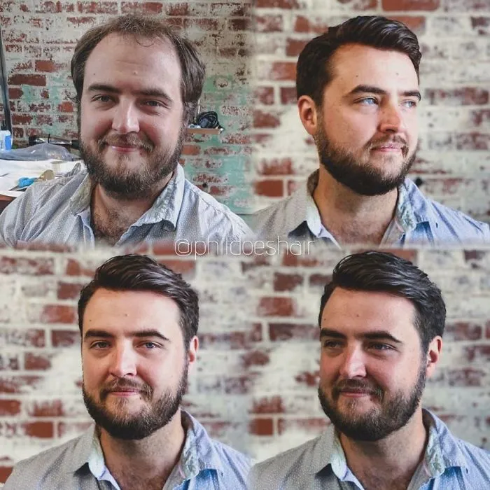 Balding Guys Try Out Non-Surgical Hair Replacements By Phil Ring, And Their Smiles Say Everything (44 Pics)