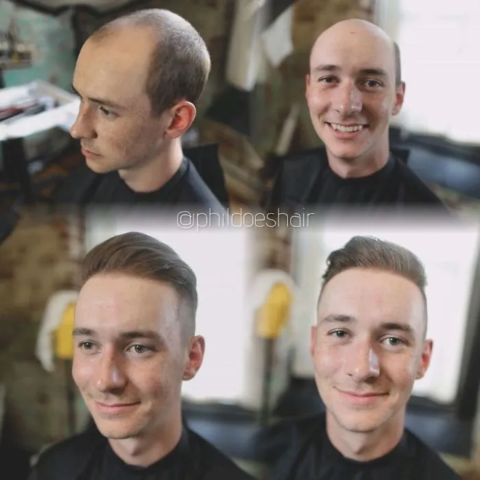Balding Guys Try Out Non-Surgical Hair Replacements By Phil Ring, And Their Smiles Say Everything (44 Pics)