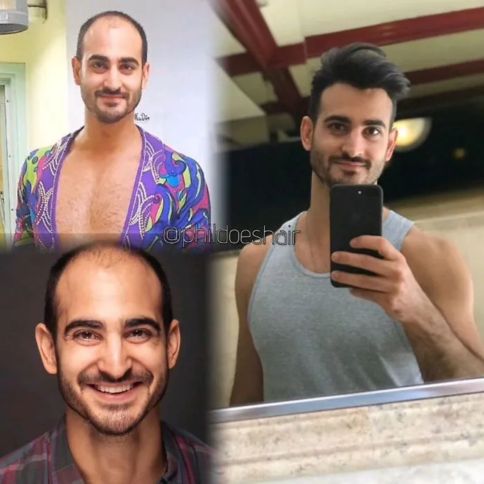 Balding Guys Try Out Non-Surgical Hair Replacements By Phil Ring, And Their Smiles Say Everything (44 Pics)