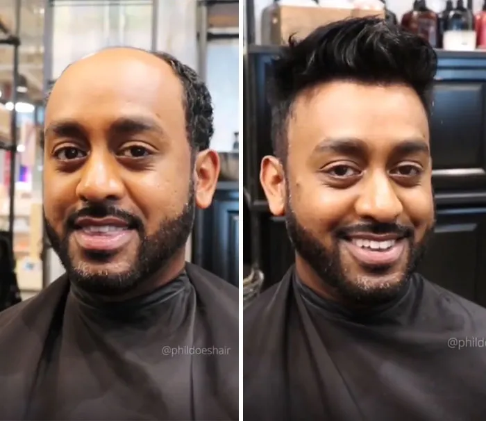 Balding Guys Try Out Non-Surgical Hair Replacements By Phil Ring, And Their Smiles Say Everything (44 Pics)