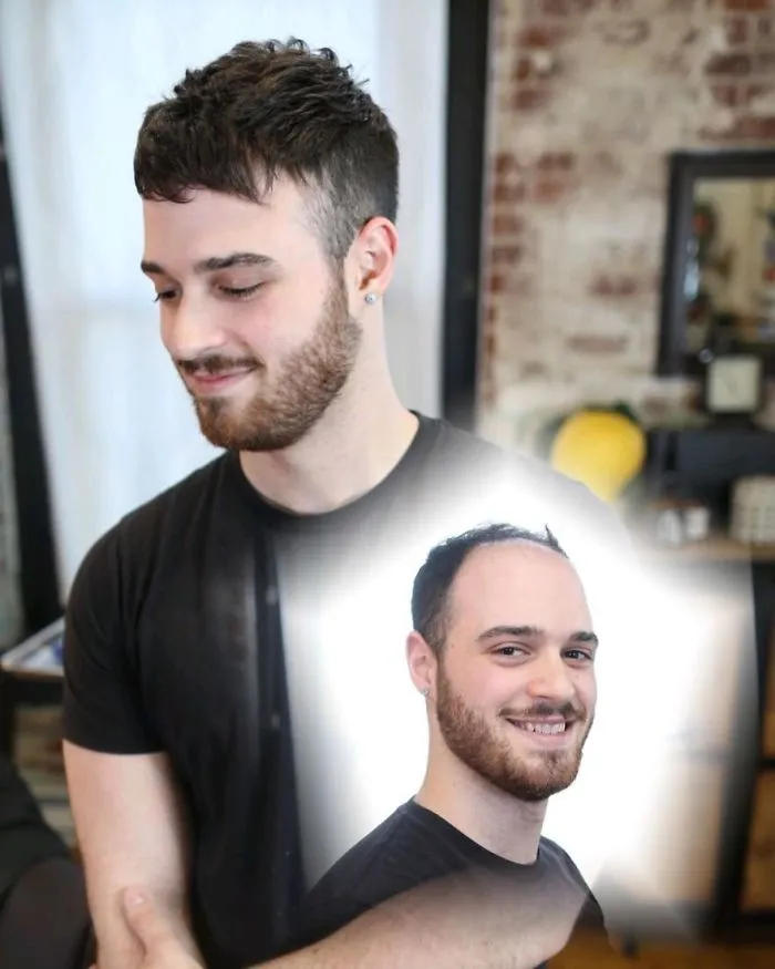 Balding Guys Try Out Non-Surgical Hair Replacements By Phil Ring, And Their Smiles Say Everything (44 Pics)