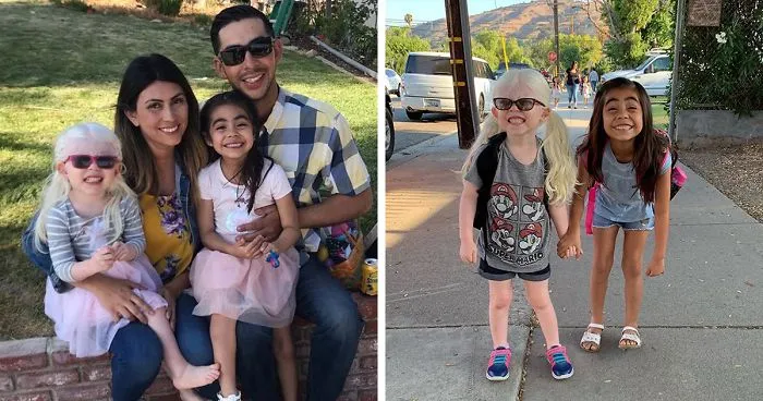 Mexican-American Parents Are Shocked After Giving Birth To A Blond Baby Girl With Light Skin