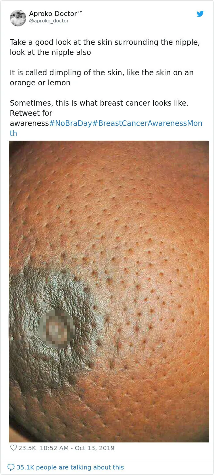 23 Powerful 'No Bra Day' Tweets That Raise Awareness About Breast Cancer