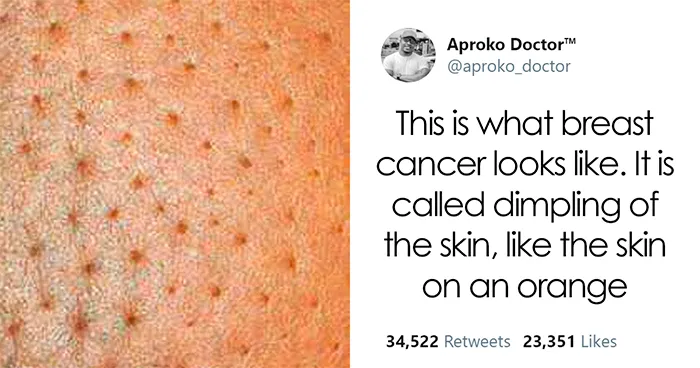23 Powerful 'No Bra Day' Tweets That Raise Awareness About Breast Cancer