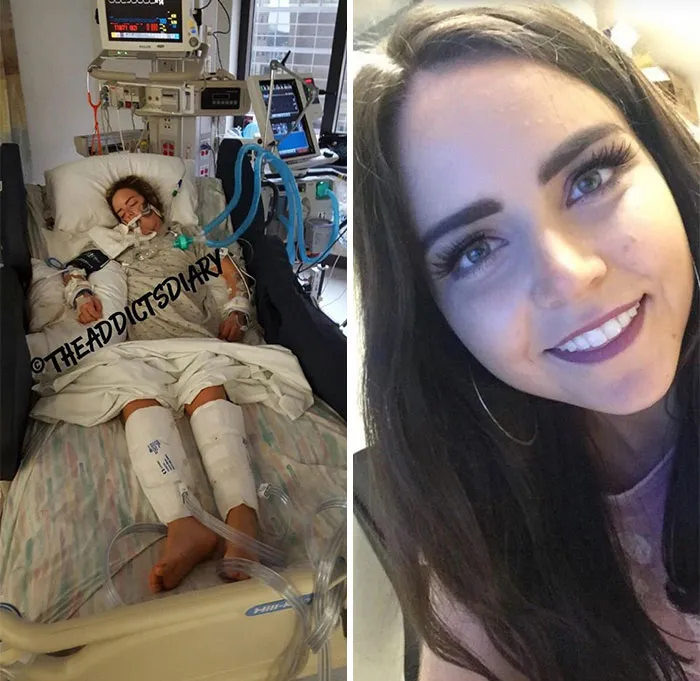 'The Addict's Diary' Showcases Before & After Transformations Of People Who Quit Drugs (30 Stories)