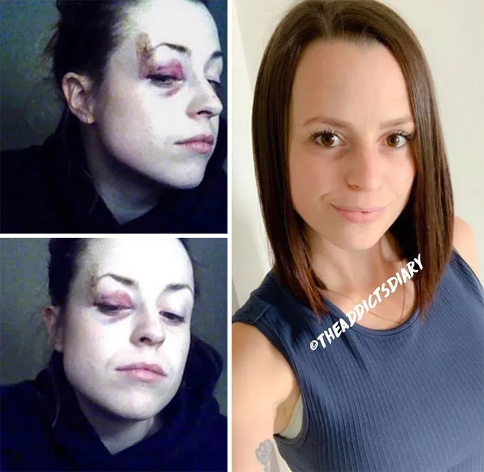 'The Addict's Diary' Showcases Before & After Transformations Of People Who Quit Drugs (30 Stories)