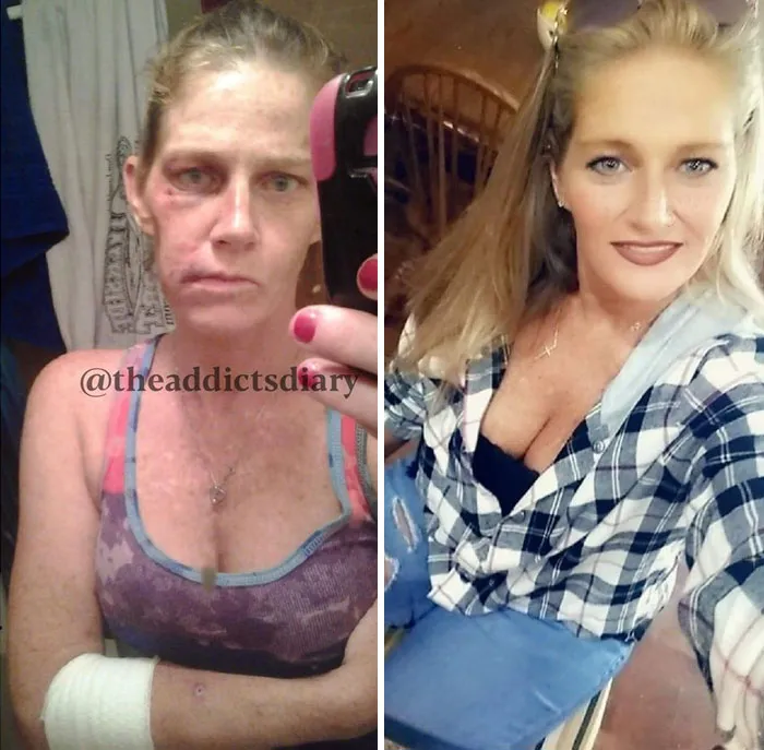 'The Addict's Diary' Showcases Before & After Transformations Of People Who Quit Drugs (30 Stories)