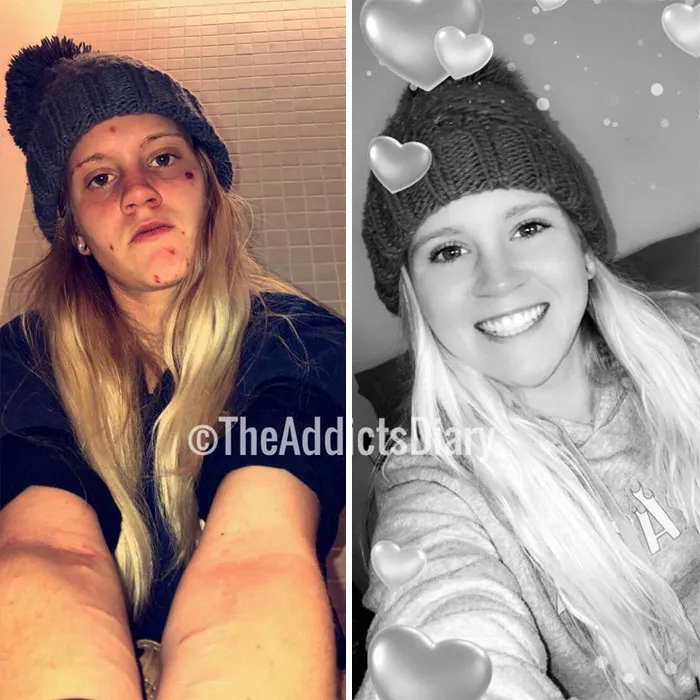 'The Addict's Diary' Showcases Before & After Transformations Of People Who Quit Drugs (30 Stories)