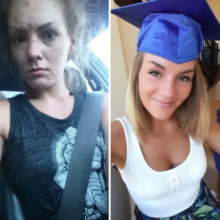 'The Addict's Diary' Showcases Before & After Transformations Of People Who Quit Drugs (30 Stories)