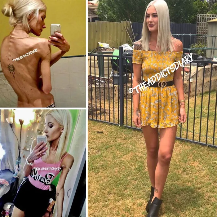Addicts-Diary-Before-After-Photo
