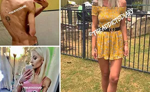 'The Addict's Diary' Showcases Before & After Transformations Of People Who Quit Drugs (30 Stories)