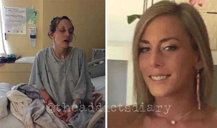 'The Addict's Diary' Showcases Before & After Transformations Of People Who Quit Drugs (30 Stories)