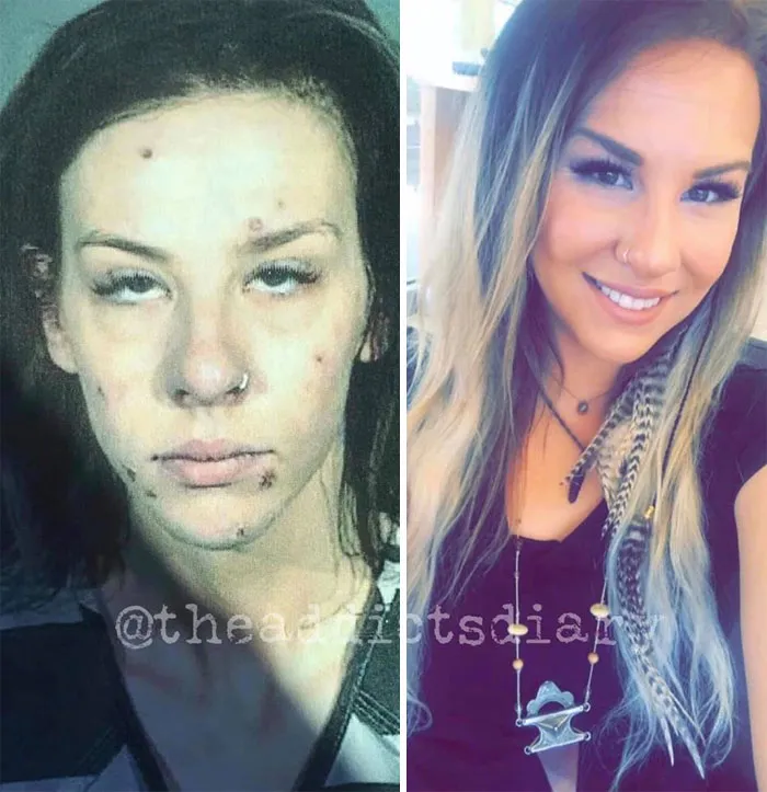 'The Addict's Diary' Showcases Before & After Transformations Of People Who Quit Drugs (30 Stories)