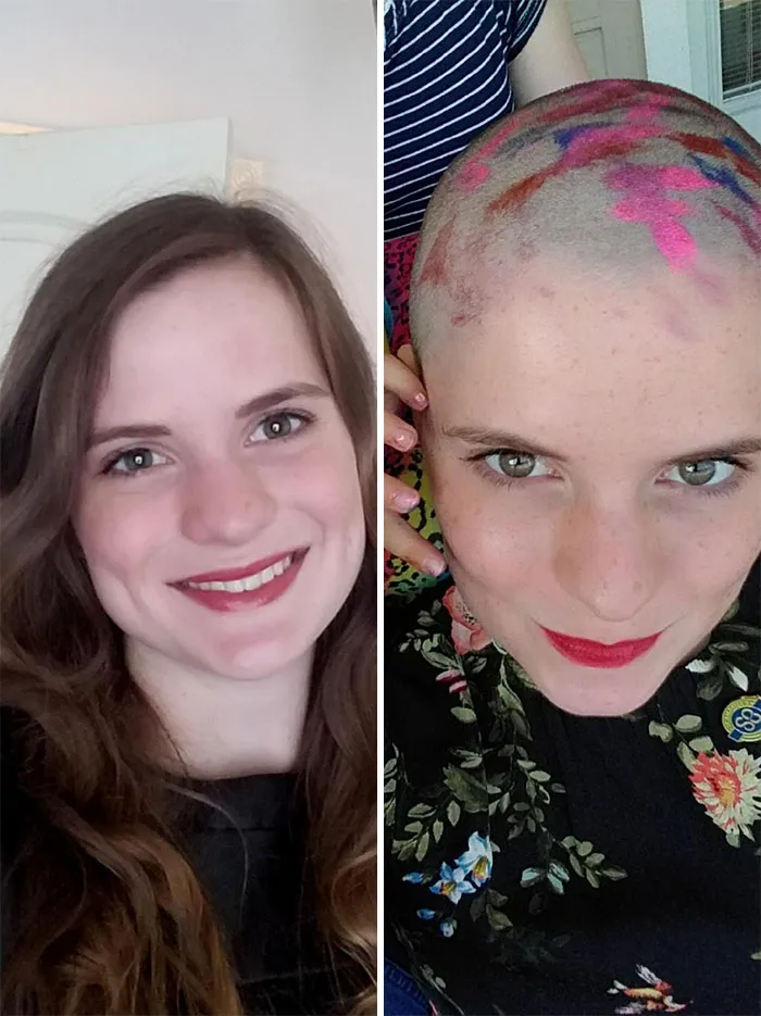Last Year I Decided To Shave Off And Donate My Waist Length Hair For St. Baldrick's And Raised $1000+ For Pediatric Cancer Research Grants