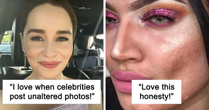 30 Times Instagrammers Showed The World Their ‘Real’ Bodies, And The Internet Admired Their 'Sanity'