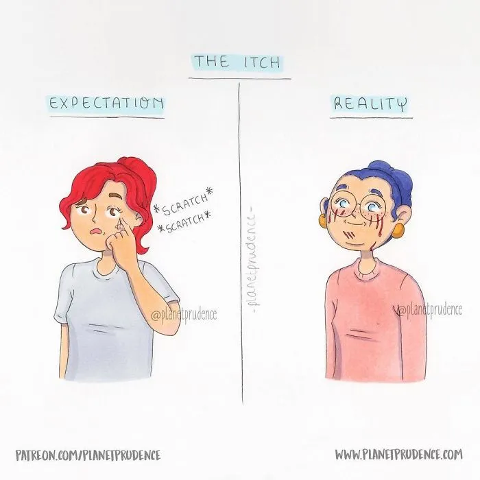A woman scratching her face, depicting the everyday problems of being a woman with an itch.