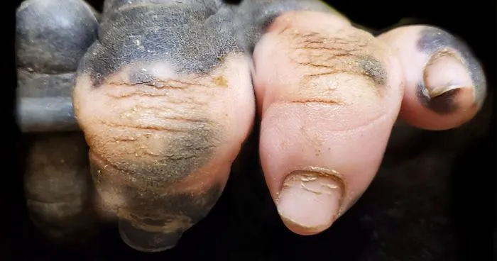 Esta gorila ha nacido sin pigmentación en los dedos y sorprende a la gente