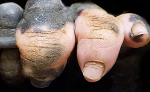 A Gorilla Born With A Lack Of Pigmentation On Her Fingers Surprises People