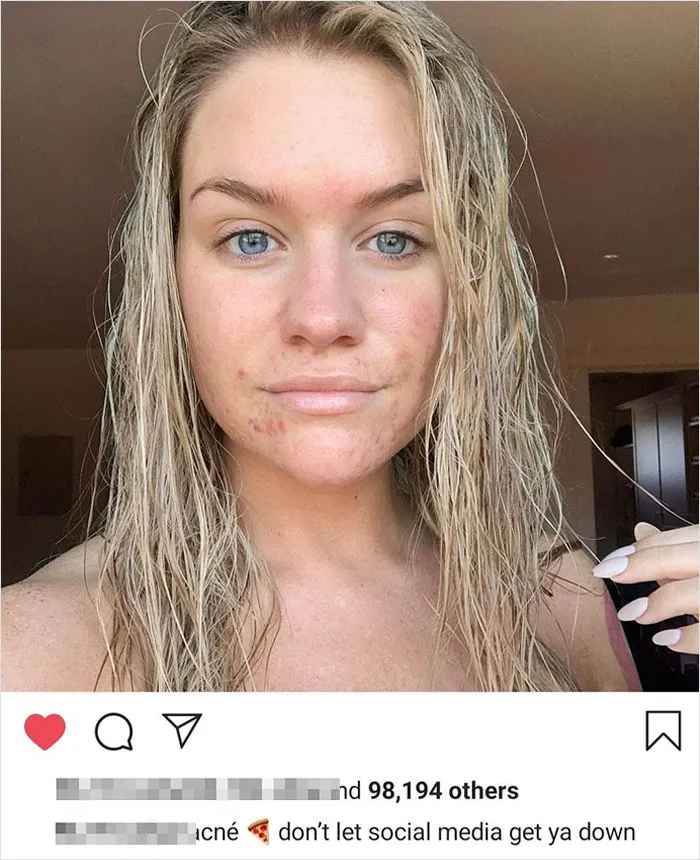 With Most People In The Beauty Influencer Industry Posting Images Photoshopped To Hell, Seeing An Artist Stop Editing Her Skin And Body Makes Me So Happy