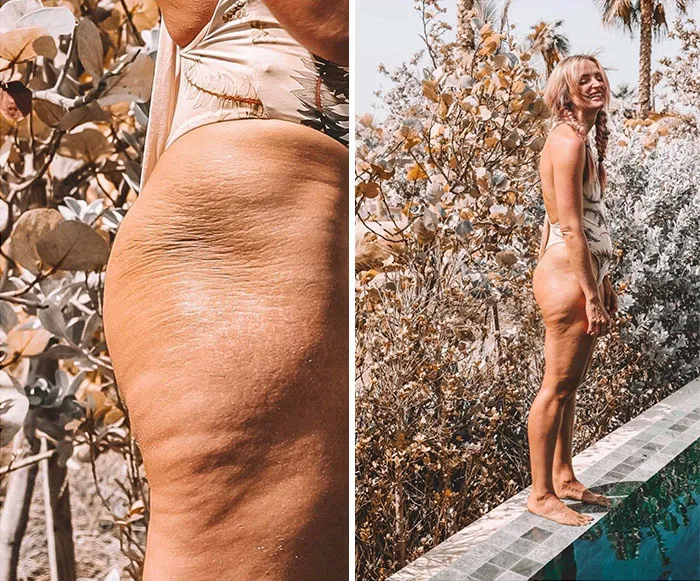 Influencer Being Real & Opening Up About Insecurities With Her Body