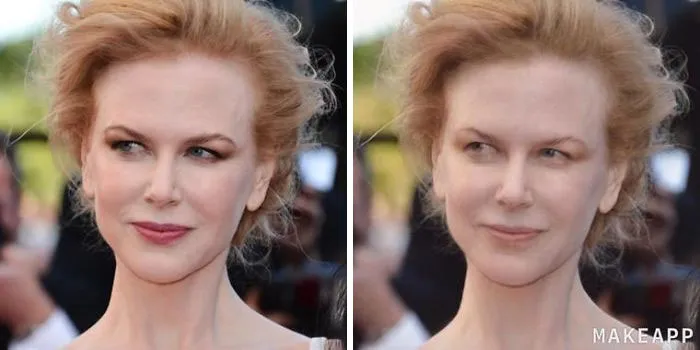 Nicole Kidman