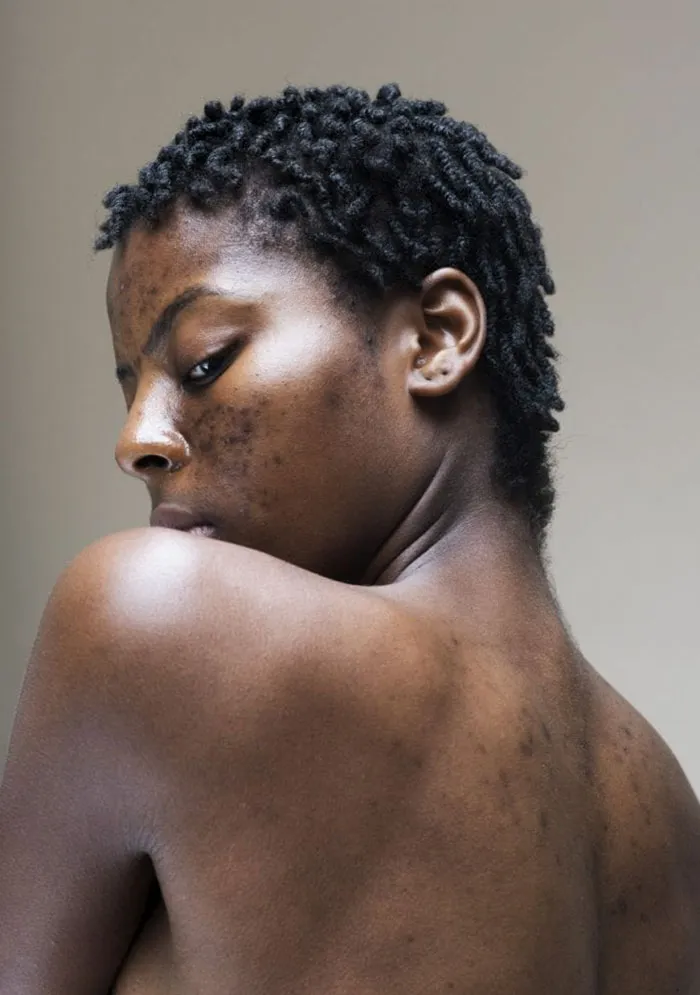 In The World Of Filters And Facetune, This Photographer Calls Us To Appreciate The Real Faces Of Women