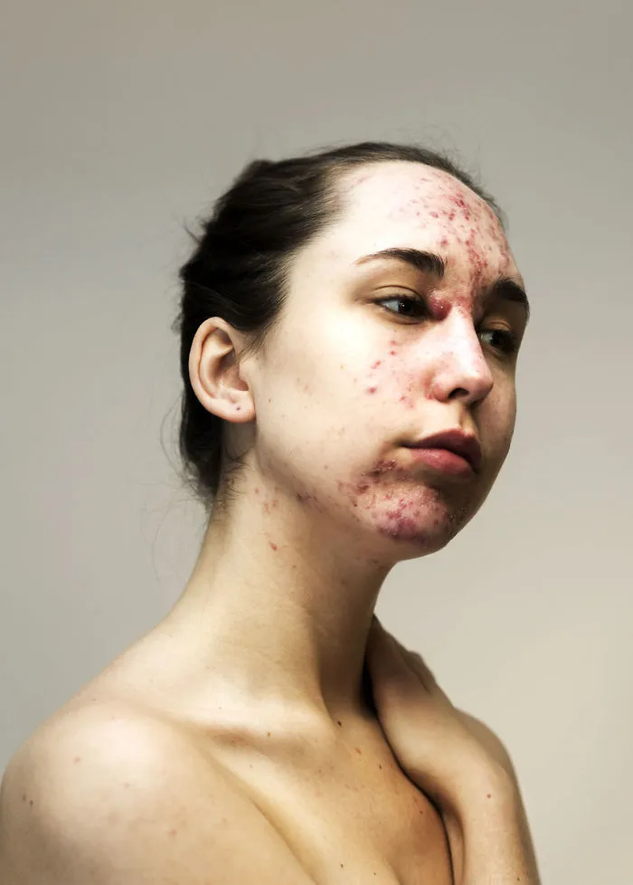 In The World Of Filters And Facetune, This Photographer Calls Us To Appreciate The Real Faces Of Women