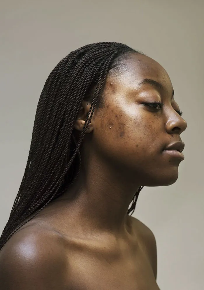In The World Of Filters And Facetune, This Photographer Calls Us To Appreciate The Real Faces Of Women