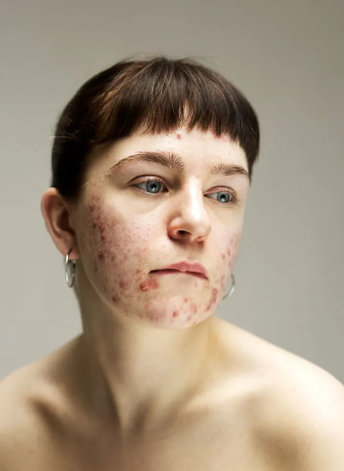 In The World Of Filters And Facetune, This Photographer Calls Us To Appreciate The Real Faces Of Women