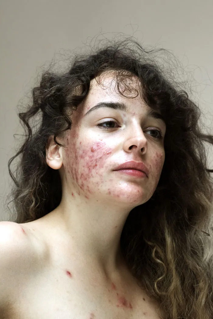 In The World Of Filters And Facetune, This Photographer Calls Us To Appreciate The Real Faces Of Women