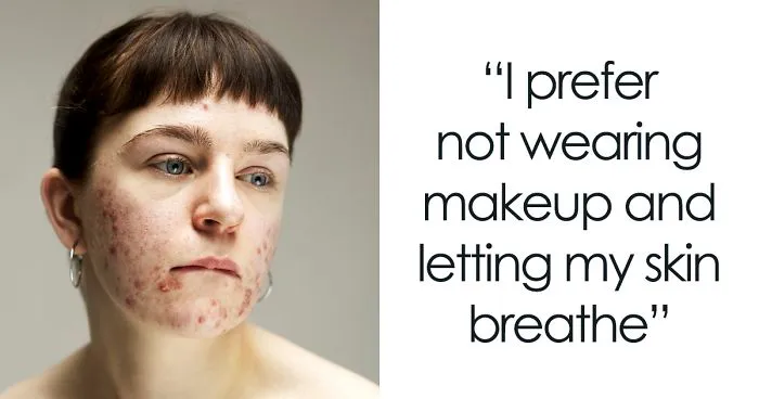 In The World Of Filters And Facetune, This Photographer Calls Us To Appreciate The Real Faces Of Women