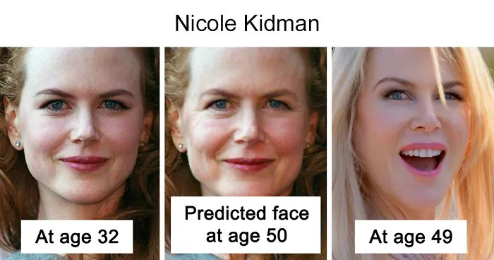Plastic Surgeon Edits 10 Celebrity Photos To Reveal How Differently They Should Actually Look