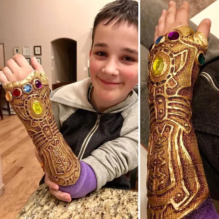 The Best Thing For A Broken Arm