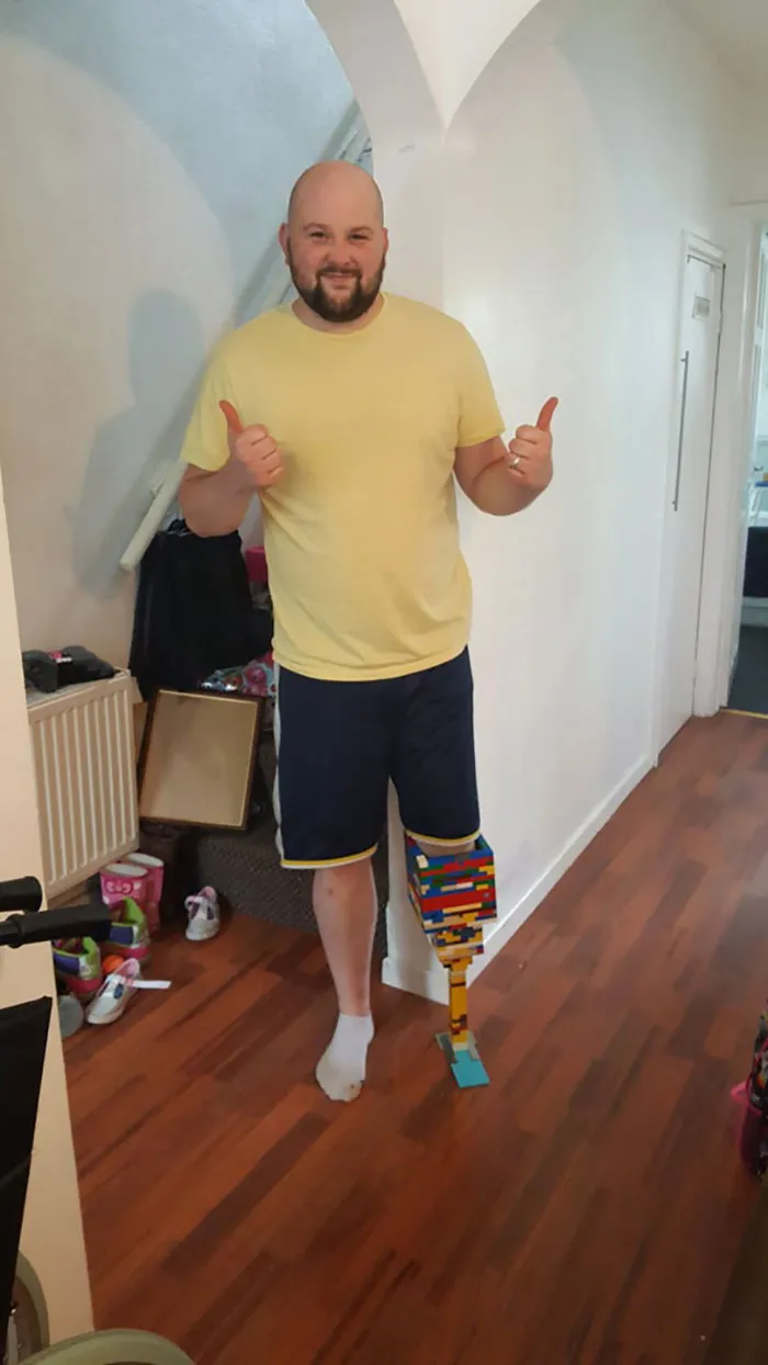 Built Myself A LEGO Leg While I Wait For My Real One To Be Built