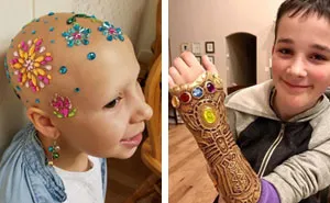 30 People With Illnesses And Disabilities Overshining Their Hardships With Humor