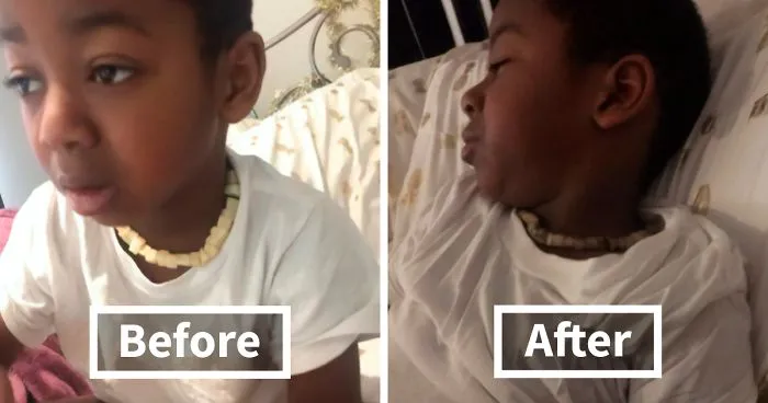 Woman Tweets Her “Genius” Potato Necklace Remedy For Her Son’s 102.3° Fever & People Online Are Facepalming
