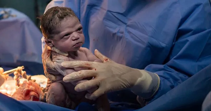 Baby Girl Stares Doctors Down Moments After Being Born, Mom Says She Was ‘Born A Ready Meme’