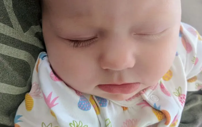 Nuestra hija tiene las pestañas de distinto color
