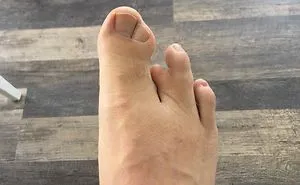 39 People Whose Genetics Made Them Unique