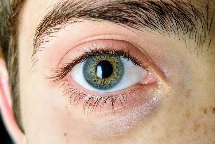 I Have A Ring Of Brown In My Eyes