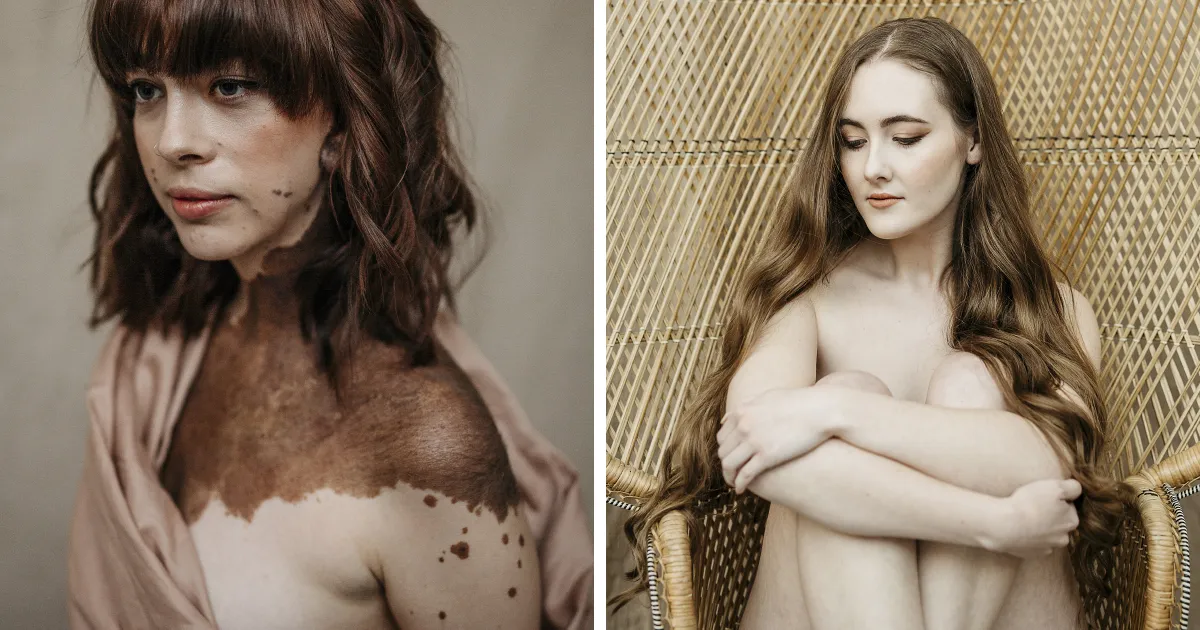 Para el Día Internacional de la Mujer, hicimos una sesión de fotos especial con mujeres que representan a personas con discapacidades y diferencias visibles