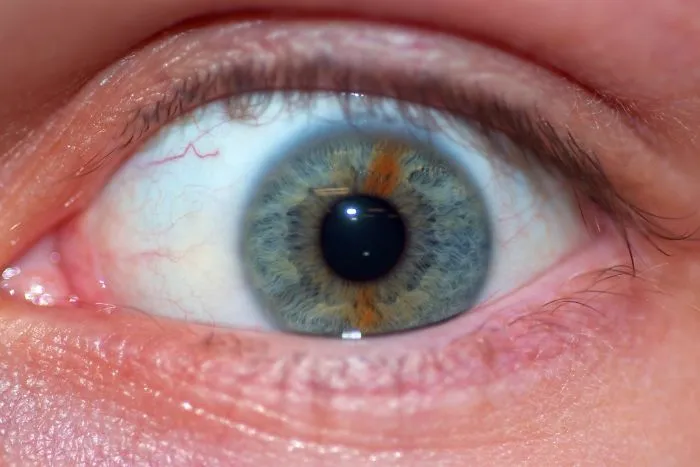 My Eye Has A Stripe Running Through It