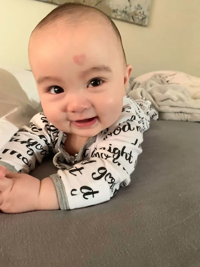 La marca de nacimiento de mi hijo