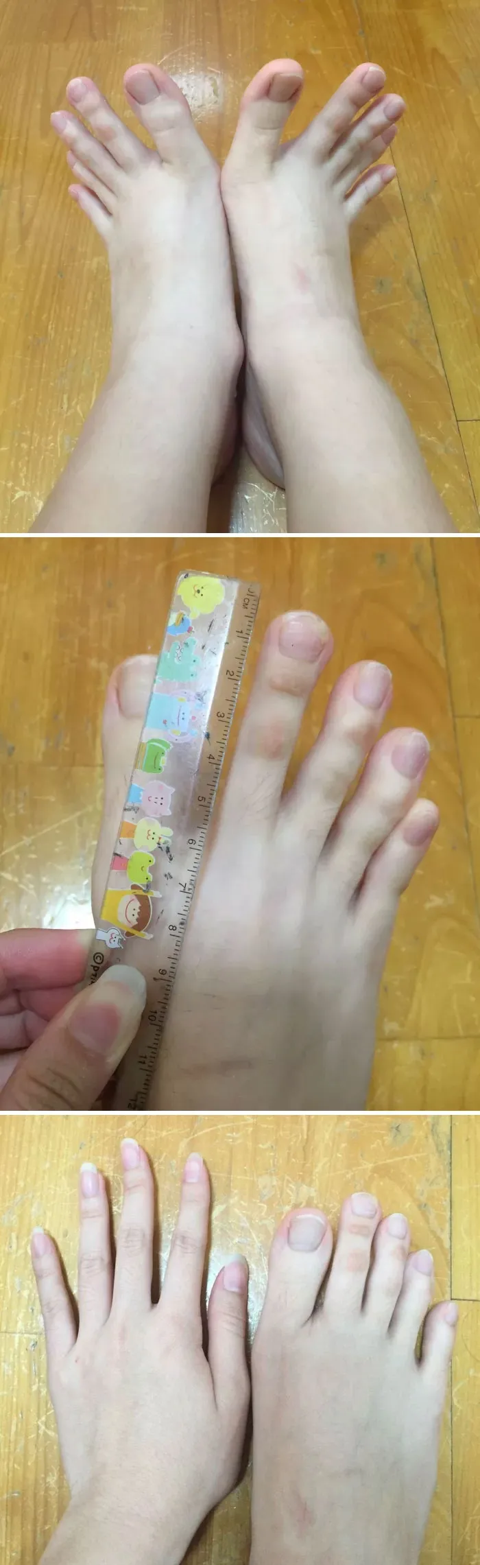 Mis dedos de los pies son inexplicablemente largos