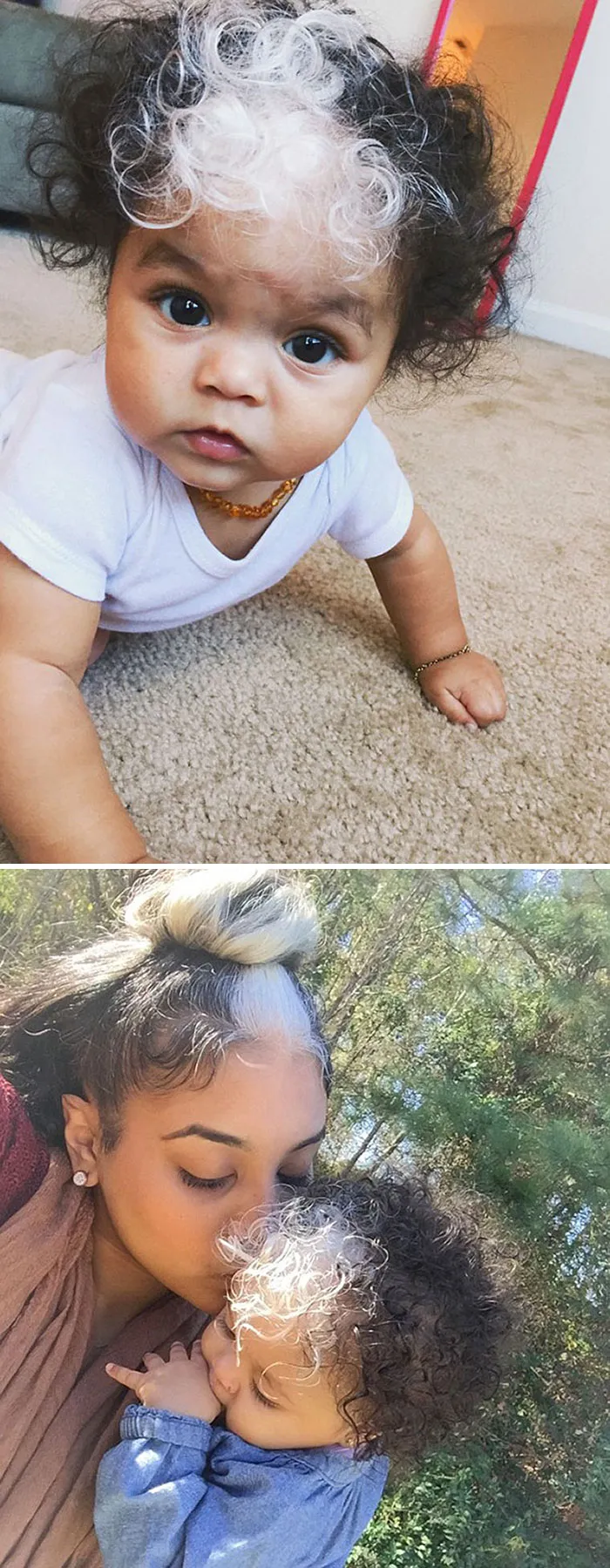 Esta niña nació con un parche de pelo blanco igual que su madre